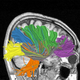 Image for article titled Reverse-Engineering of Human Brain Likely by 2020